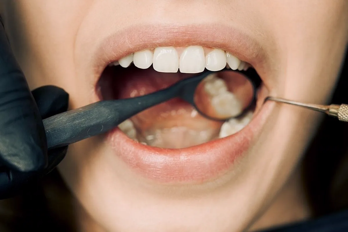Dental clinician closely examining a patient's teeth and gumline